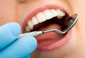 Having more than 8 fillings could increase mercury levels in your blood 